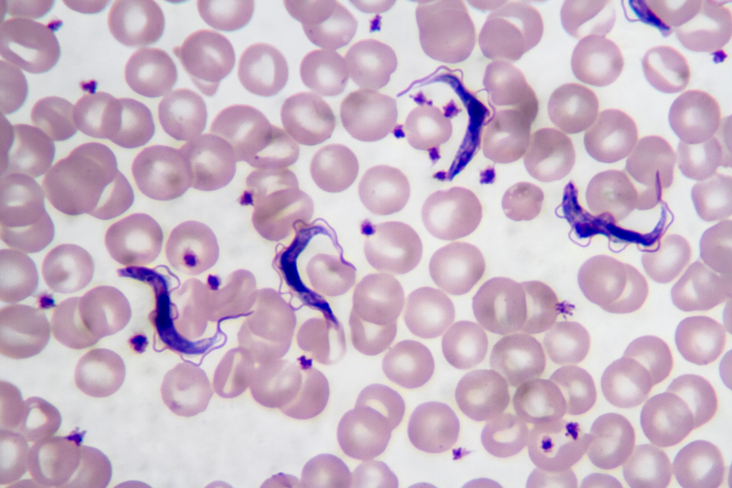 Trypanosoma cruzi en frotis sangu&iacute;neo