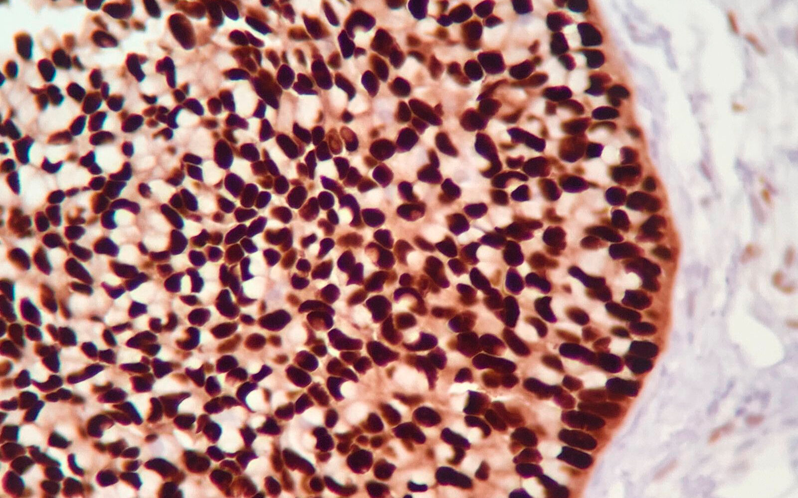 Laboratorio de inmunohistoquímica